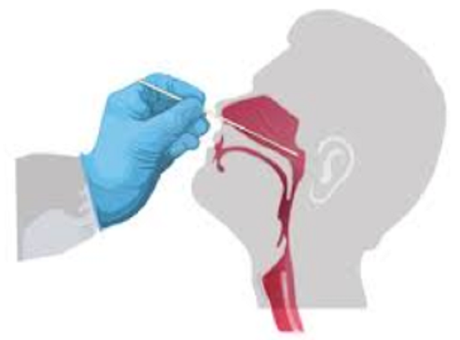 Người tự test nhanh COVID-19 tại nhà cần lưu ý những gì?