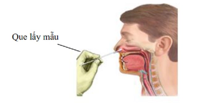 Người tự test nhanh COVID-19 tại nhà cần lưu ý những gì?
