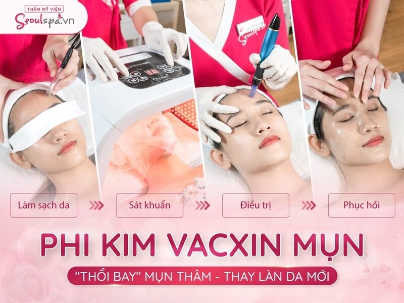 Thẩm mỹ viện SeoulSpa.Vn - Địa điểm cải thiện nhan sắc uy tín